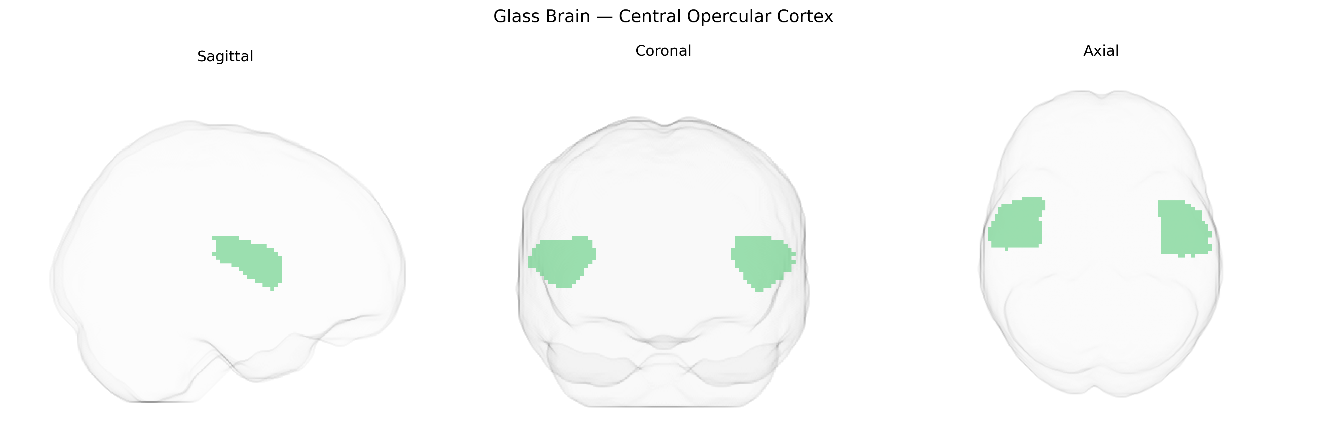 Triplanar Ghost Brain