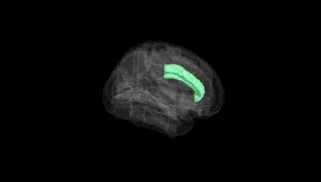 Full Brain Black