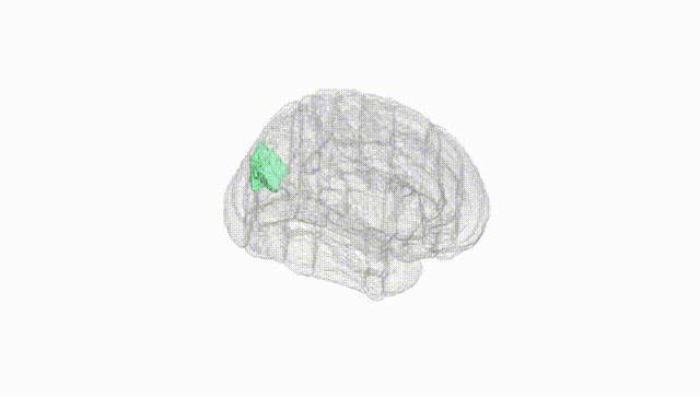 Full Brain White