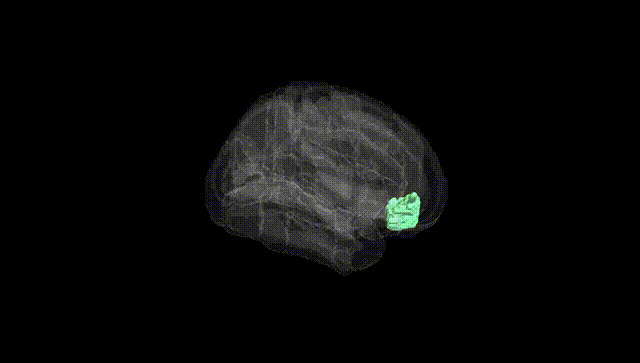 Full Brain Black