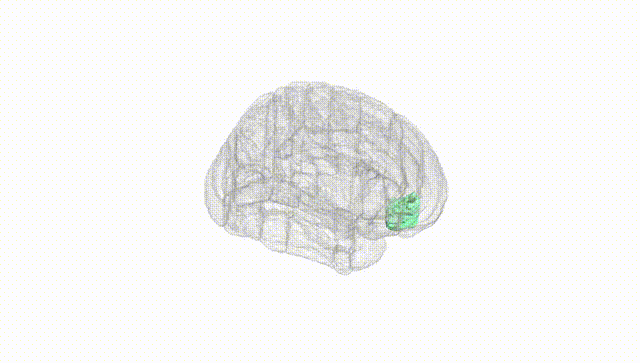 Full Brain White