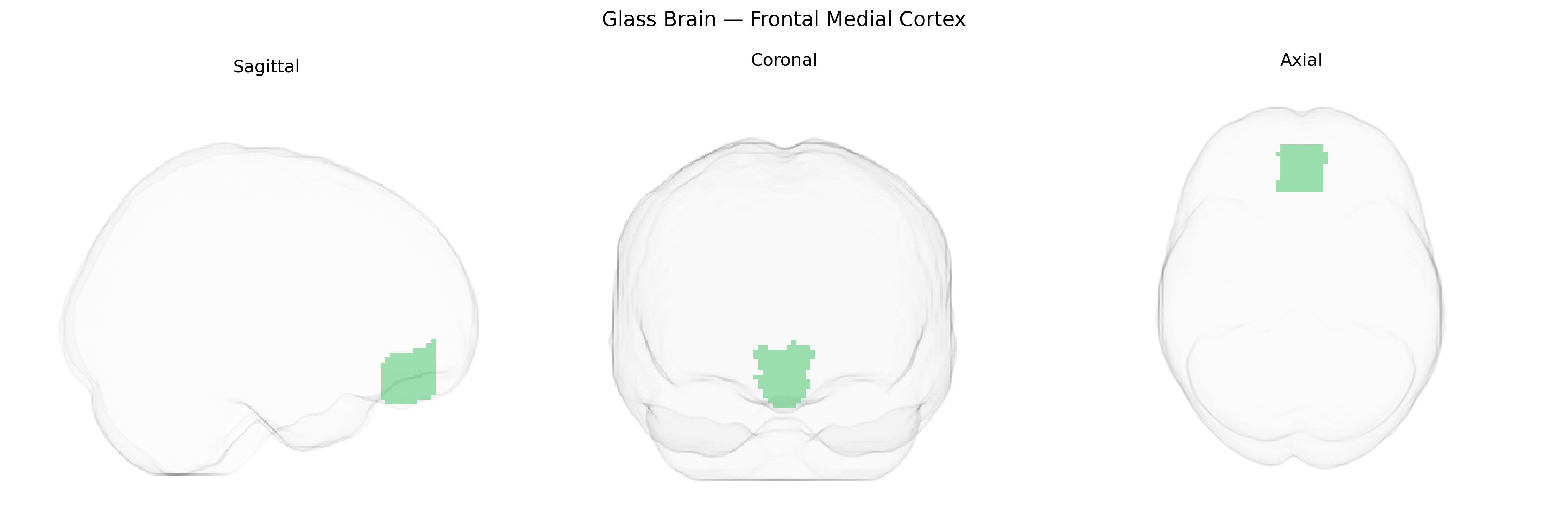 Triplanar Ghost Brain