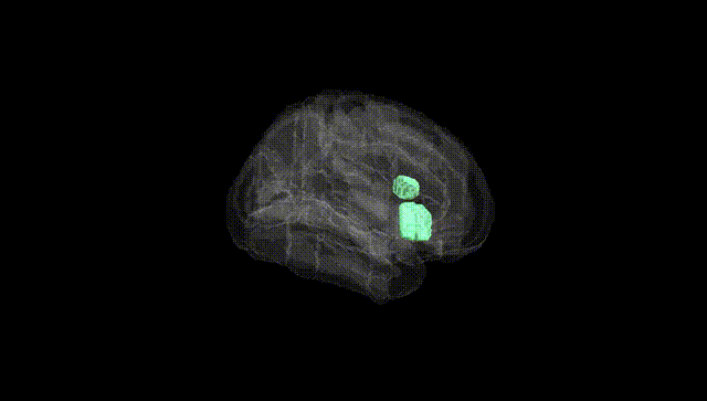 Full Brain Black