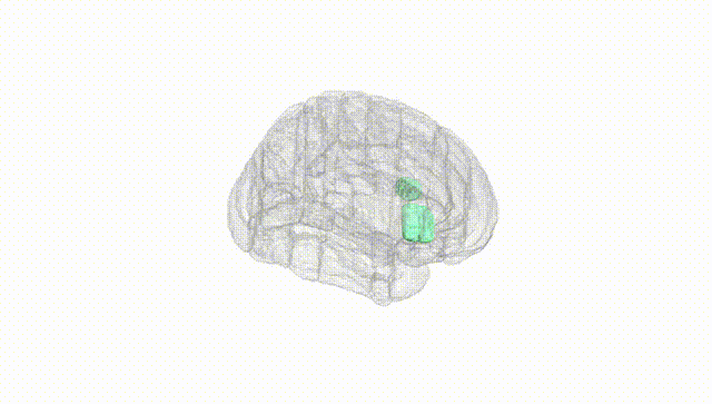 Full Brain White