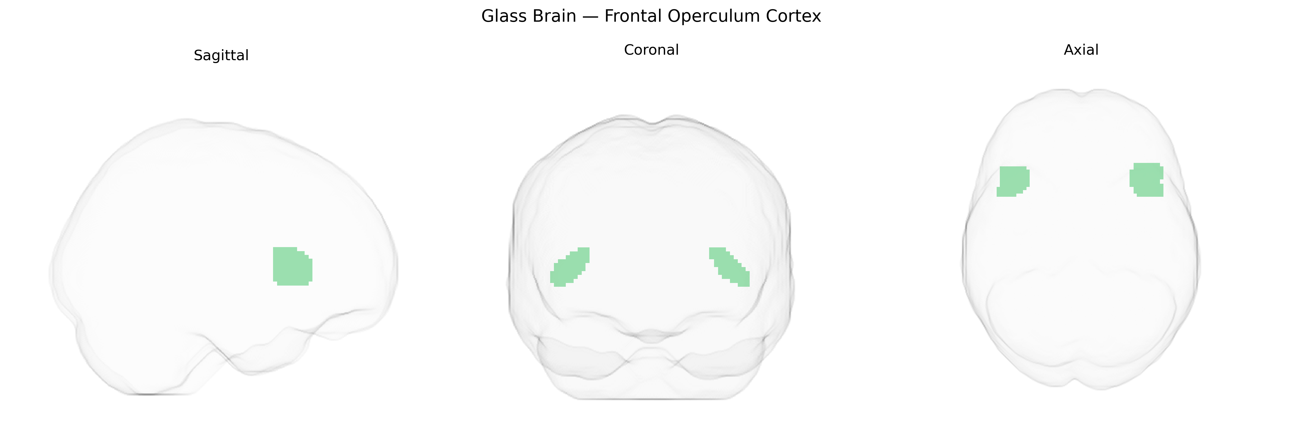 Triplanar Ghost Brain