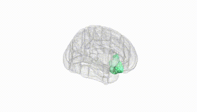 Full Brain White