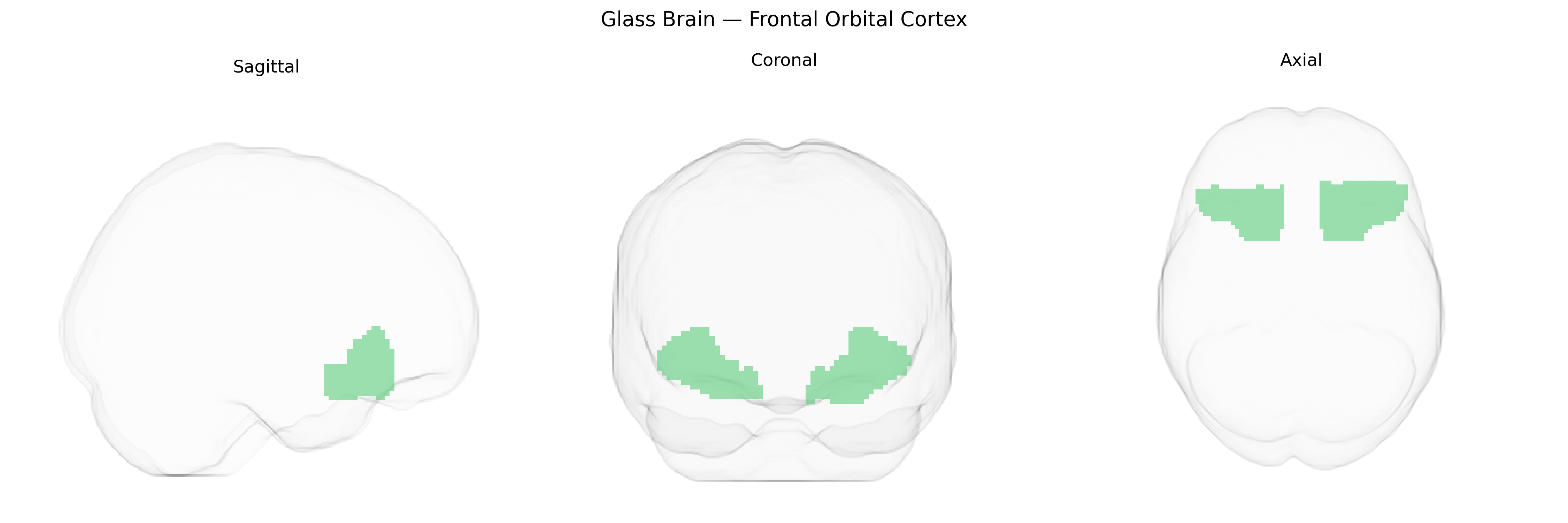 Triplanar Ghost Brain