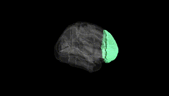 Full Brain Black