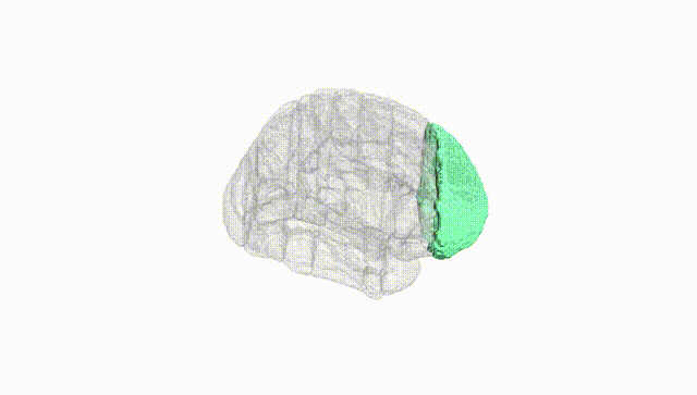 Full Brain White