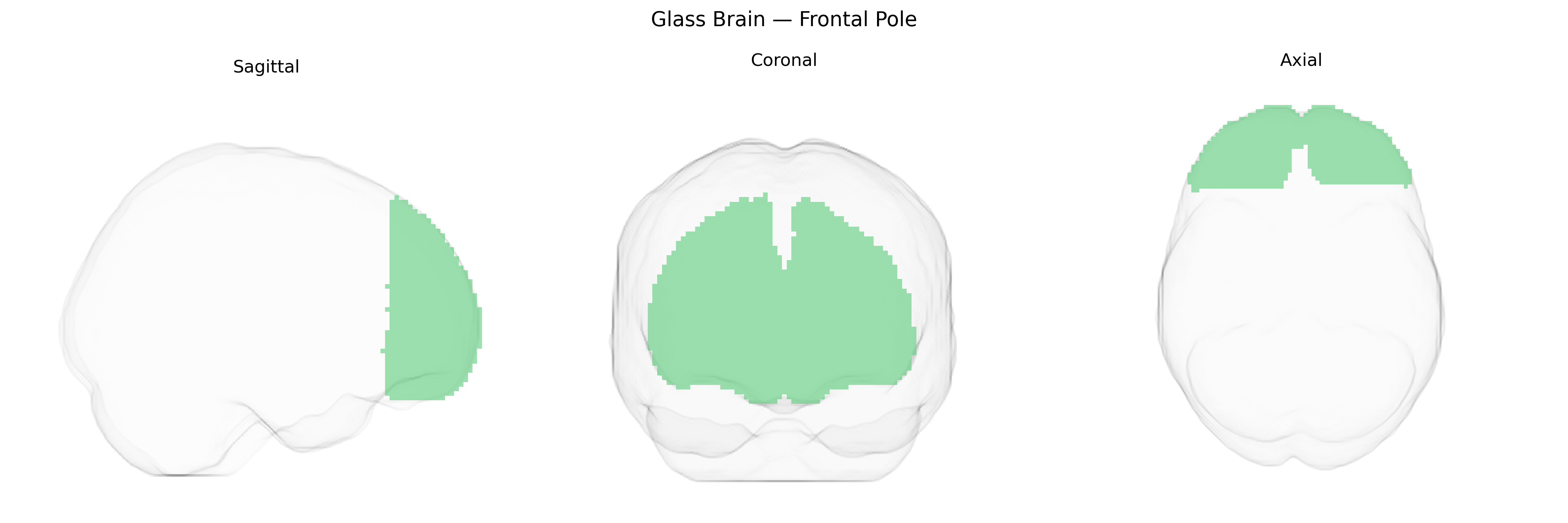 Triplanar Ghost Brain