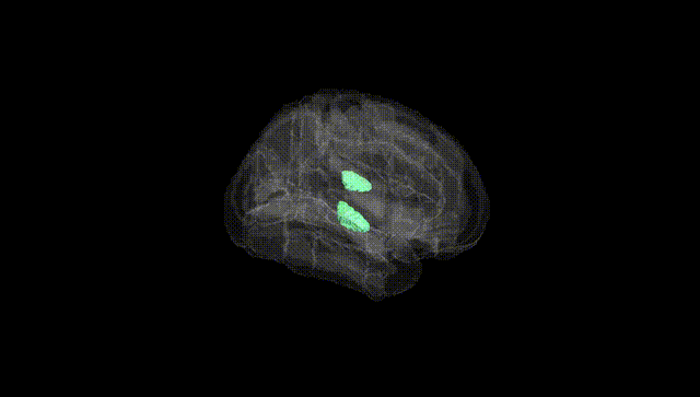 Full Brain Black