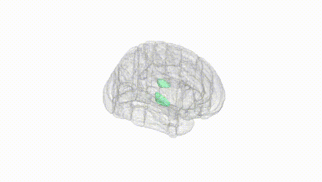 Full Brain White