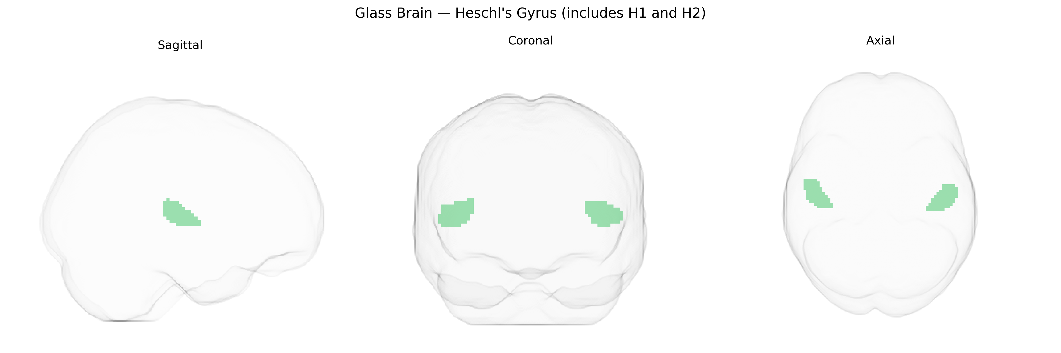 Triplanar Ghost Brain