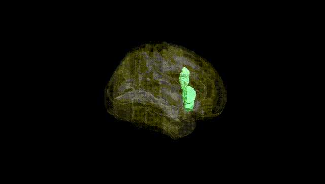 Full Brain Black