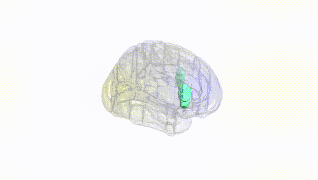 Full Brain White