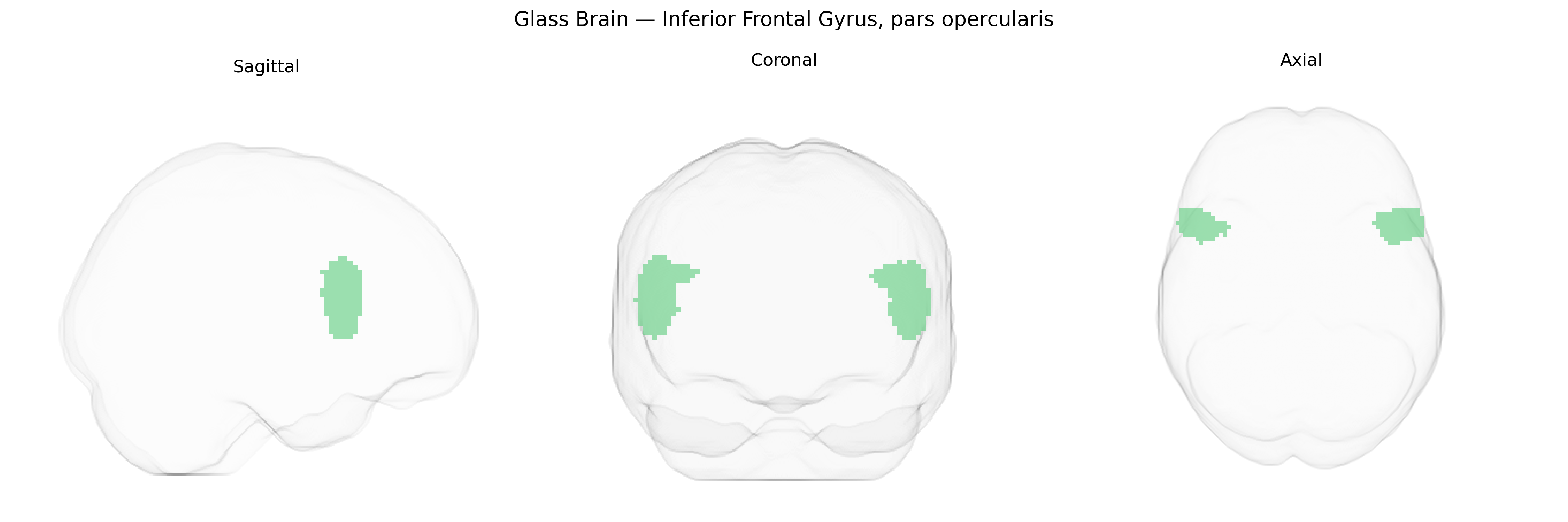 Triplanar Ghost Brain
