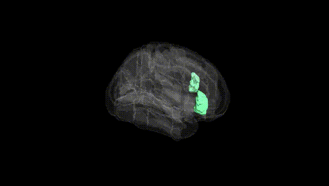 Full Brain Black