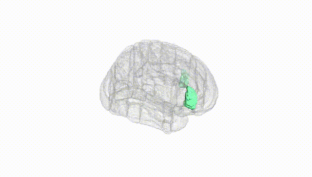 Full Brain White