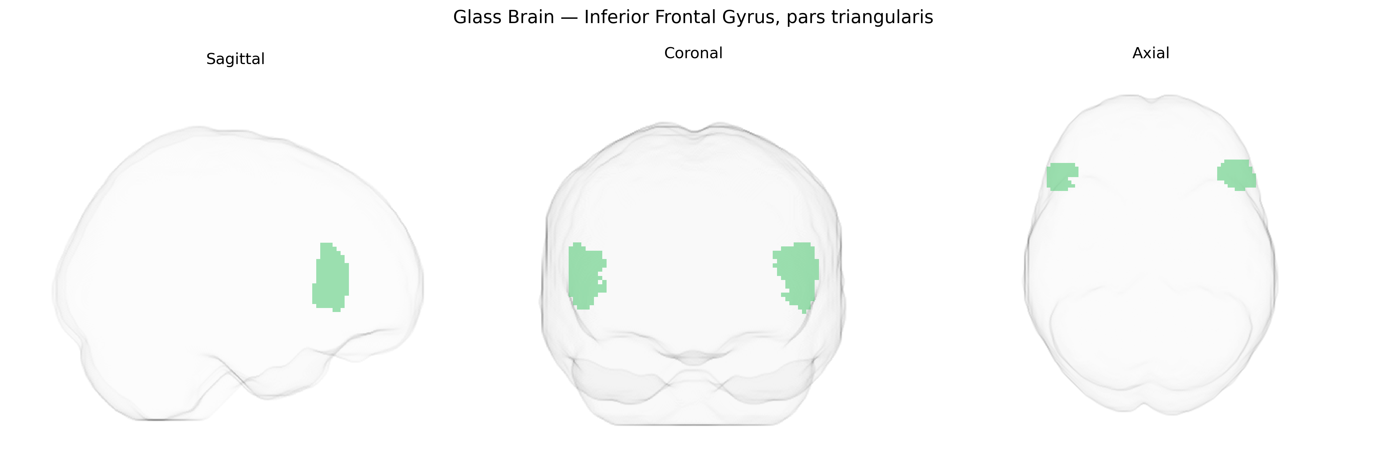 Triplanar Ghost Brain
