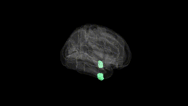 Full Brain Black