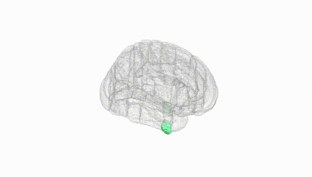 Full Brain White