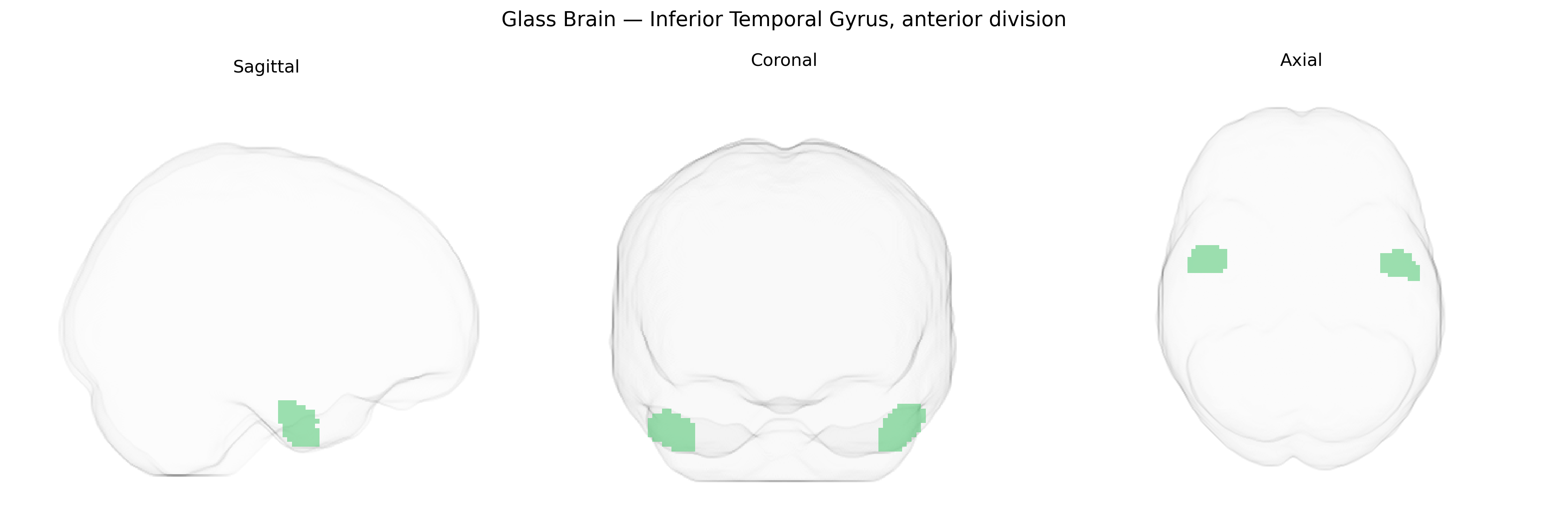 Triplanar Ghost Brain