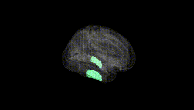 Full Brain Black