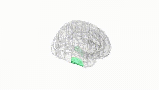 Full Brain White