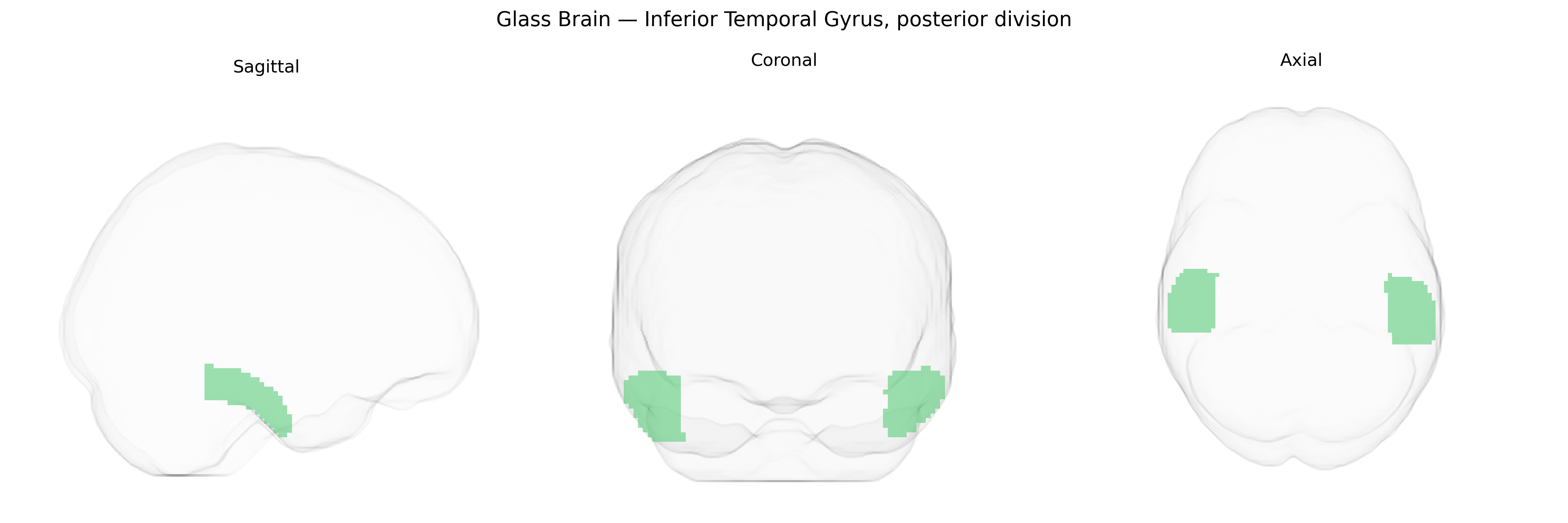 Triplanar Ghost Brain