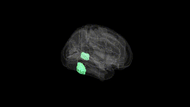 Full Brain Black
