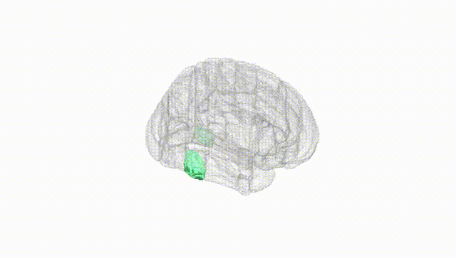 Full Brain White