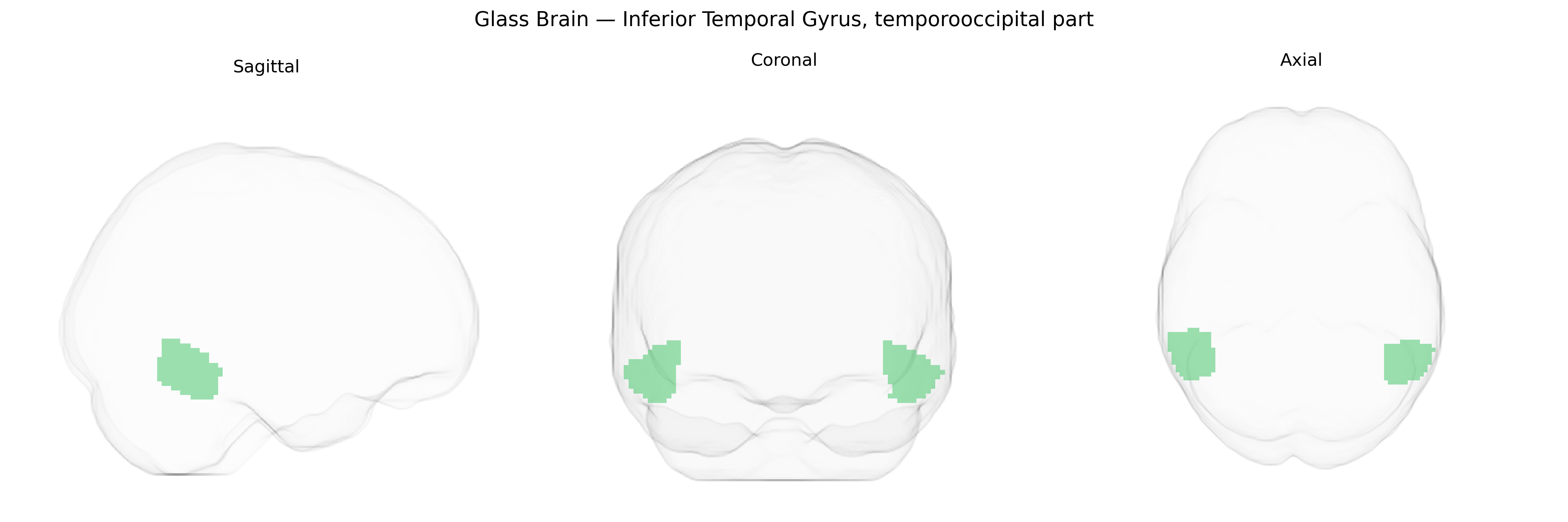 Triplanar Ghost Brain