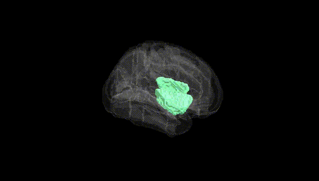 Full Brain Black