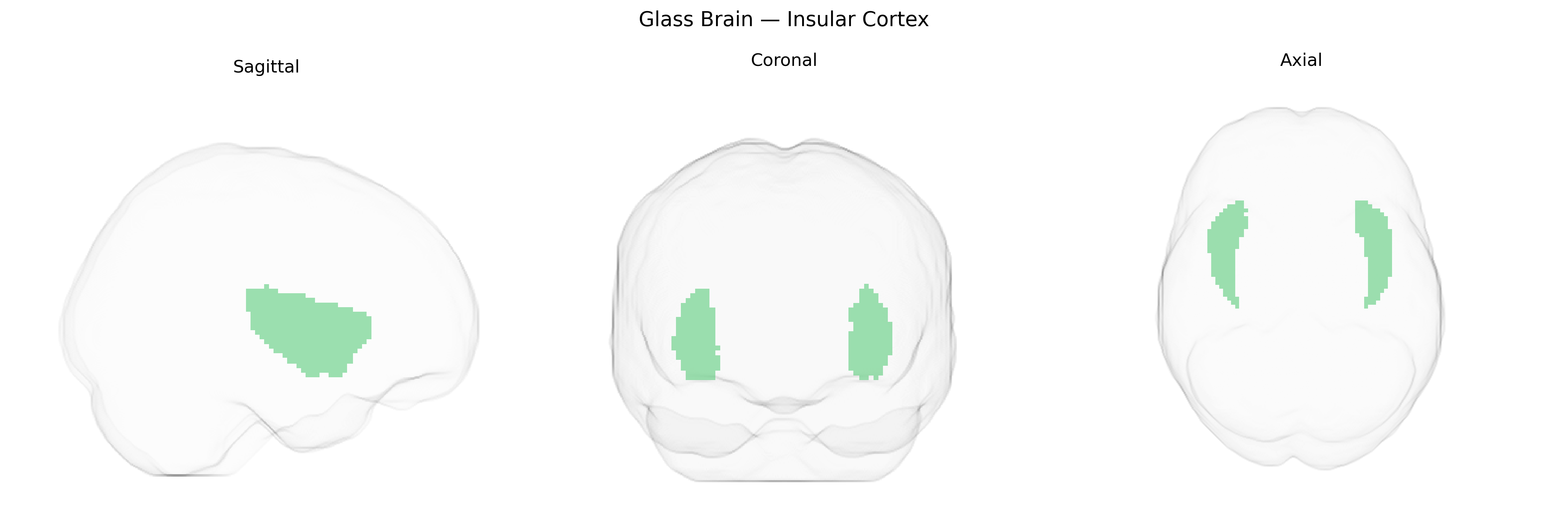 Triplanar Ghost Brain