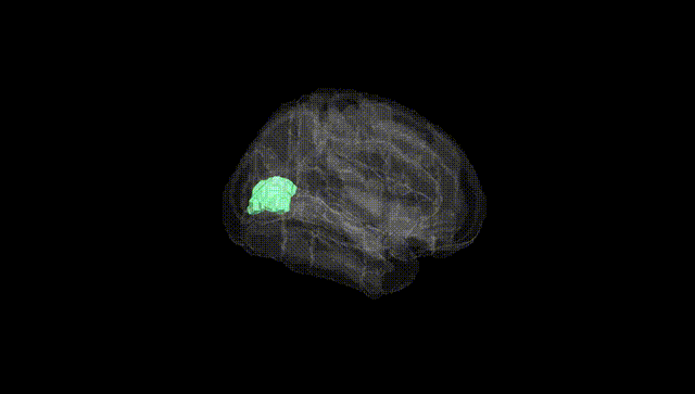 Full Brain Black