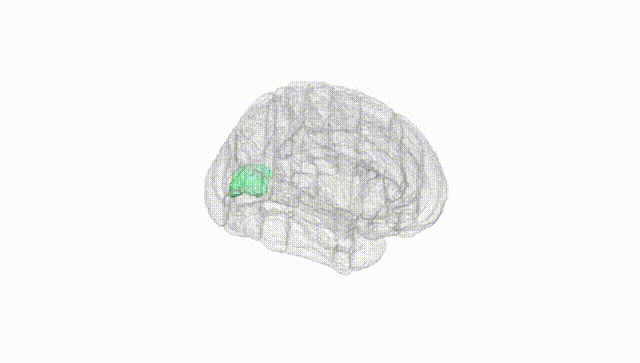 Full Brain White