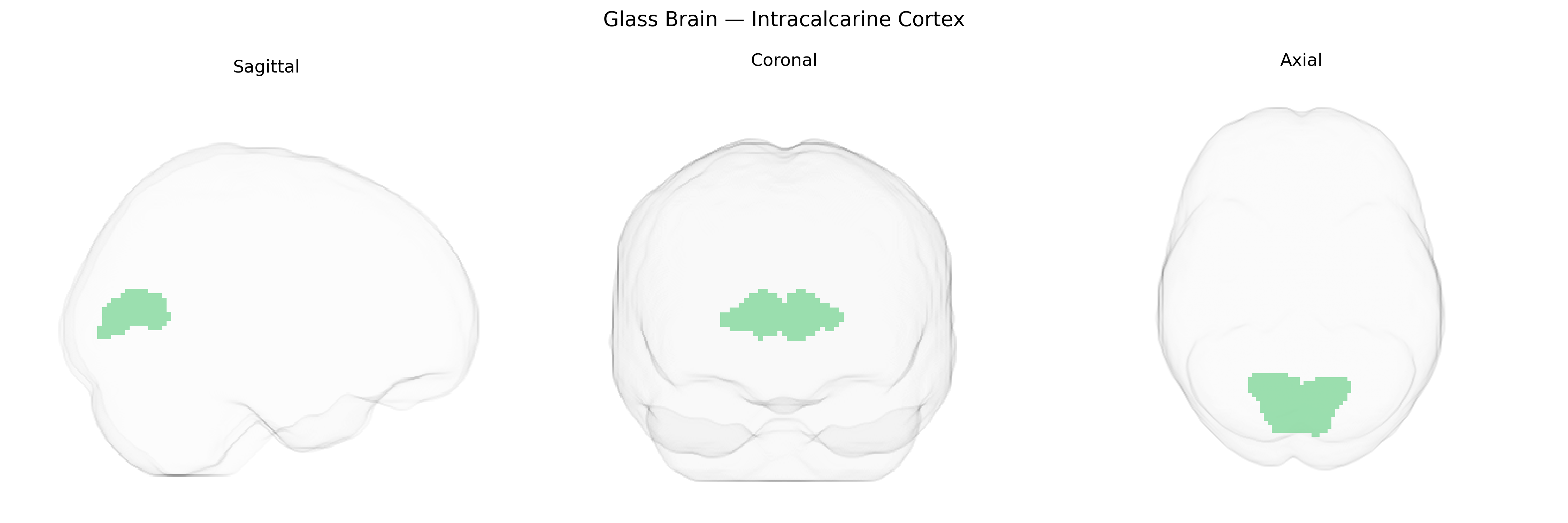 Triplanar Ghost Brain