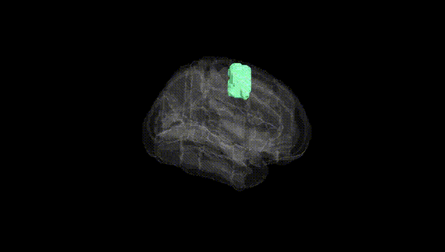 Full Brain Black