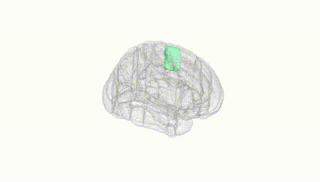 Full Brain White