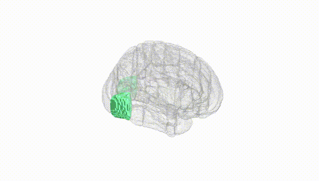 Full Brain White