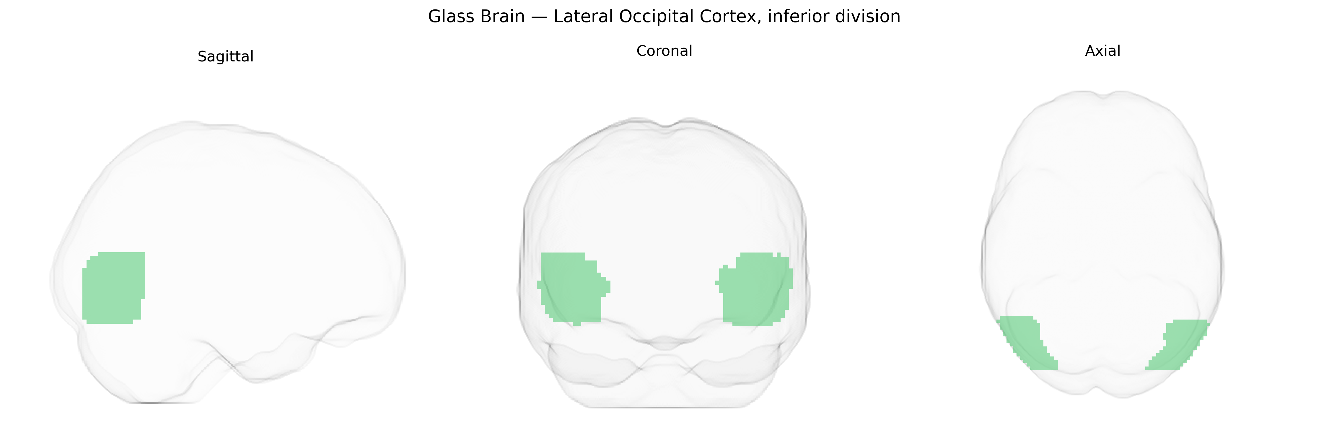 Triplanar Ghost Brain