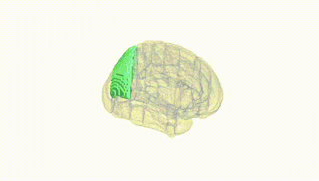 Full Brain White