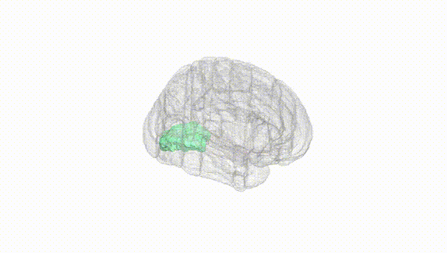 Full Brain White
