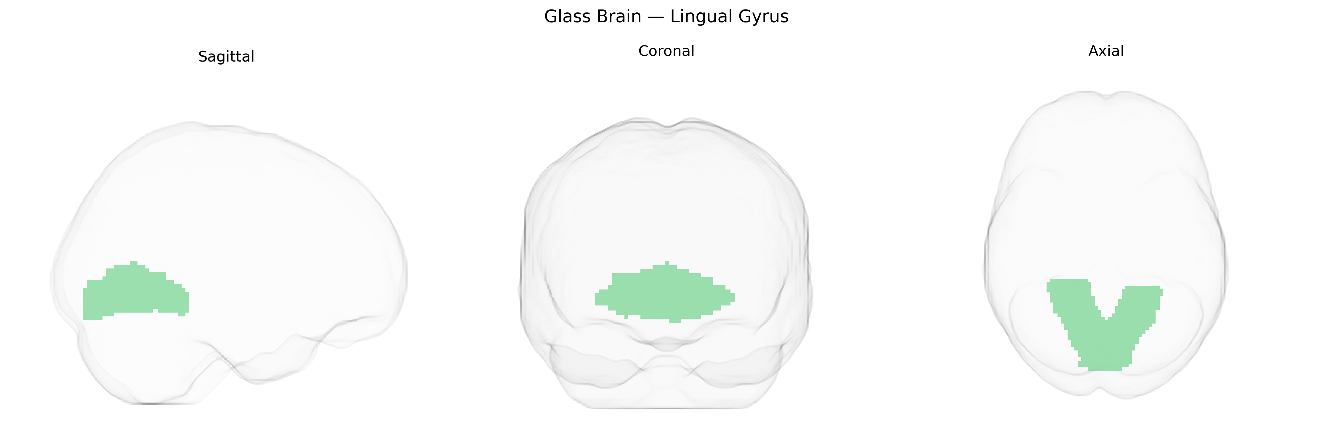 Triplanar Ghost Brain