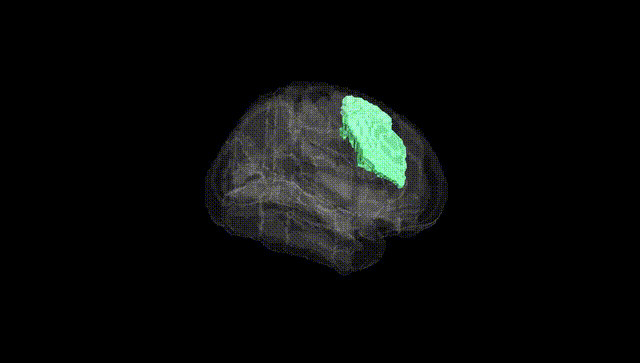 Full Brain Black