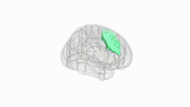 Full Brain White
