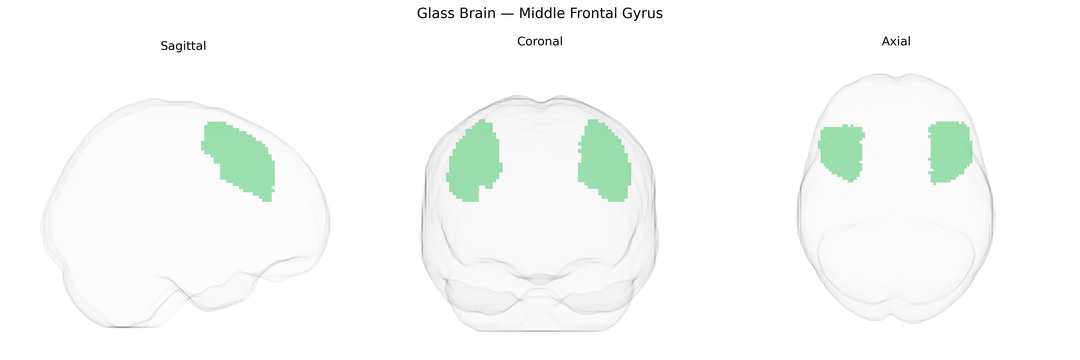 Triplanar Ghost Brain