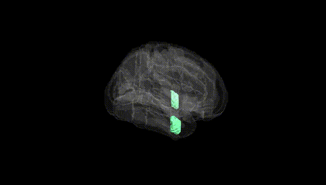 Full Brain Black