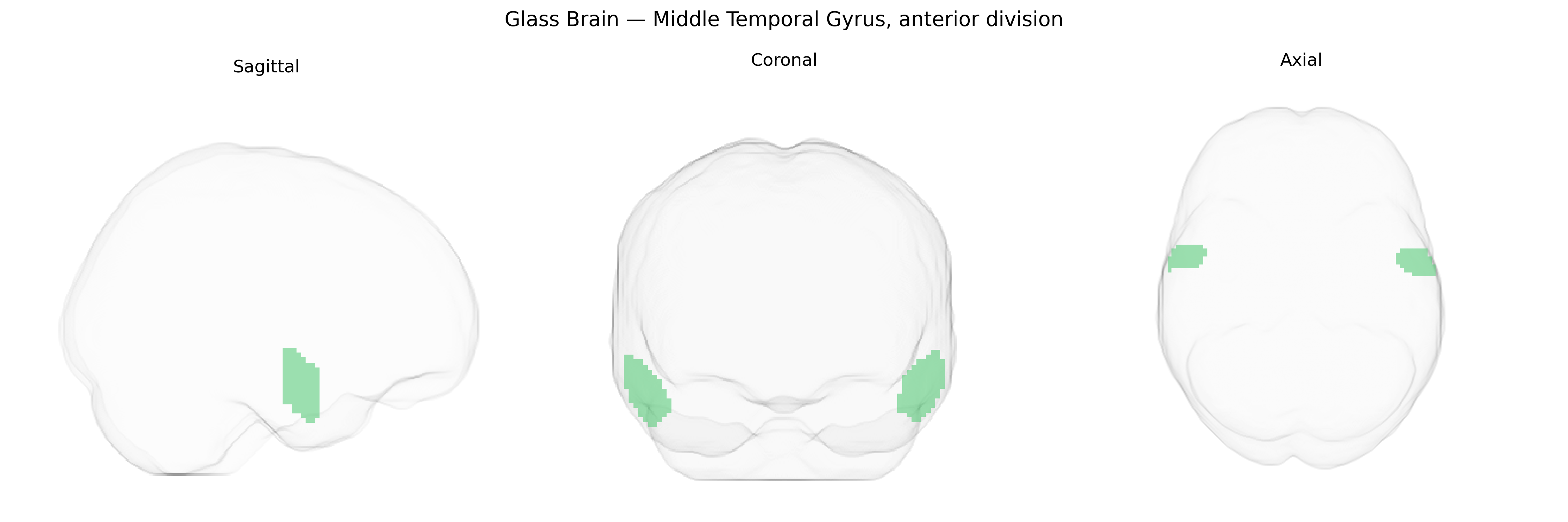 Triplanar Ghost Brain