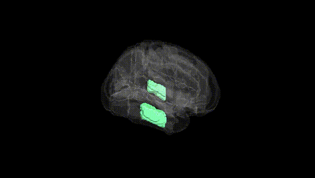 Full Brain Black